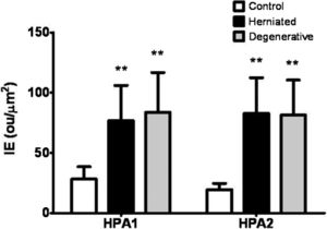 Analysis of HPA1 and HPA2 immunohistochemical results. The values indicate the expression index (IE) obtained from digital quantification after immunohistochemical reactions using specific HPA1 C20 and HPA2 C17 antibodies (Santa Cruz, Biotechnology, CA, USA) as described in the Methods. **P<0.001, Mann-Whitney Test, in comparison with the control IE values.