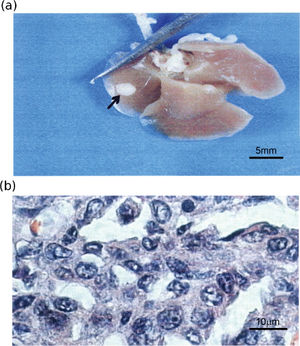 (a) Photograph of lung obtained from urethane-treated animals showing nodule formation; (b) Photomicrograph of tissue section obtained from fixed lungs of urethane-treated animals and stained with Hematoxilin and Eosin showing atypical adenoma. x 1000.