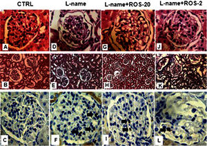 Histological and immunohistochemical analysis. Representative glomerular sections stained with hematoxylin/eosin (A,D,G,J; 400×), cortical sections stained with Masson's trichrome (B,E,H,K; 20×) and immunohistochemical analyses of glomerular macrophages (C,F,I,L) in each group of rats (n = 10/group). These analyses did not detect changes in the glomerular, vascular, tubular or interstitial compartments. Glomerular macrophages were most abundant in the L-name group (arrow).