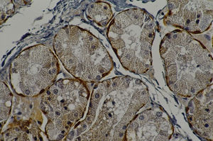 Immunohistochemical staining of calponin on myoepithelial cells (Pilo, original magnification 400X).