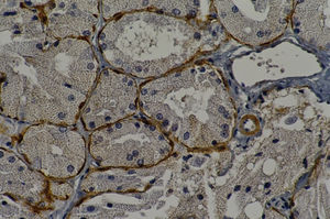 Immunohistochemical staining of calponin on myoepithelial cells (V30, original magnification 400X).