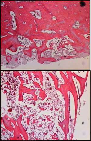 Photomicrographs of bone defect consolidation in an animal in the PRP group (a) and the BMC group (b).