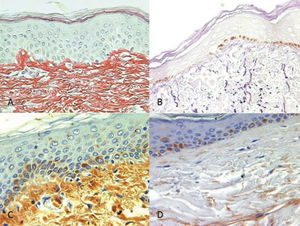 Photomicrographs of total collagen fibers (A), elastic fibers (B), collagen III (C) and versican (D) stained for histological analysis (400X magnification).