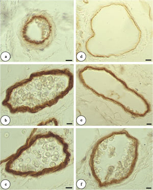 Changes of laminin expression in arterioles (A-C) and venules (D-F) by immunohistochemical staining (light microscopy, 1000X). a. The intimal layers of the hamsters in the control group were immunoreactive for laminin. b and c. All layers showed positive laminin staining for both diabetic groups. d. The control group showed a poorly labeled intimal layer. e. The diabetic group (6 days) with all layers staining positive. f. The diabetic group (15 days) with all layers staining positive. The scale bar = 10 μm.