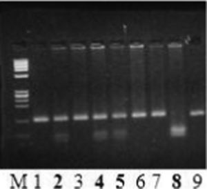 Electrophoresis of PCR and RFLP – The lines 2, 4 and 5 indicate the heterozygous pattern. The line 8 represents the homozygous pattern and the M corresponds to the molecular weight marker Øx.
