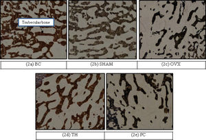 Effects of Tualang honey on structure of femur bone. All pictures are stained with Von Kossa and examined under X20 magnification: BC = Baseline control group; SHAM = Sham- operated control group; OVX = Ovariectomised control group; TH = Tualang honey treated group at 0.2 g/kg/bw; PC = Positive control group (1% calcium).