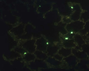 Immunofluorescence microscopy (TUNEL) imaging for cell death analysis. Fluorescent-labeled cells (green) correspond to tissue death by apoptosis.