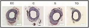 Photomicrographs of tracheal sections from the four studied groups (EC, C, S and TO) on GD 21.5 showing increased epithelial thickness and decreased chondral thickness in the TO group. Bar = 250 μm.