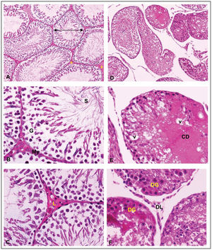 Histology of the testes of treated and untreated group (H&E staining). Figure 1 (A–C): Normal histological structure of rat's testis. Normal structure of seminiferous tubules (⇒) and interstitial tissue (∗)(Figure 1A). The seminiferous tubule consists of normal somatic, sperm (S) and spermatogenic cells (G) surrounded with peritubularmyoid cells (My)(Figure 1B). Clusters of Leydig's cells (L) were observed in the intertubular space that was in close contact with blood vessels and lymphatic channels (Figure 1C). Figure 1(D–F): Histology of FNT rat testis showing: degenerative of germ cells (DG) and Leydig cells (DL), expansion of interstitsial space, cellular debris (CD), vacuoles (v) and disarrangement of spermatogonia throughout the lumen of seminiferous tubule. (Magnification A and D∼X10; Magnification B, C, E and F∼X40).