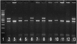 hsp65/IS6110 multiplex PCR. Lane 1 – 100 bp ladder; lanes 2, 6, and 8 – MTC strains; lanes 3, 4, 5, 7, 9, 10, and 11 – NTM; lane 12 – M. avium; and lane 13 – M. tuberculosis.