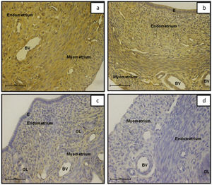 Photomicrographs of uterine tissues stained with antibody to ER-α. (a) Control, (b) Gen 10, (c) Gen 100, (d) Negative control. GL: endometrial gland; E: epithelium; BV: blood vessel. ∗Negative controls were performed by omitting the primary and secondary antibody. Scale bar = 50 μm