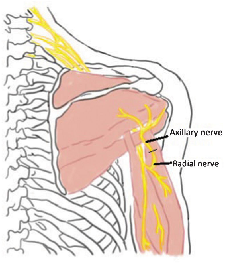 Axillary Nerve Rfa What has changed in brachial plexus surgery? | Clinics