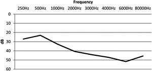 The mean audibility threshold for all frequencies and audiograms.