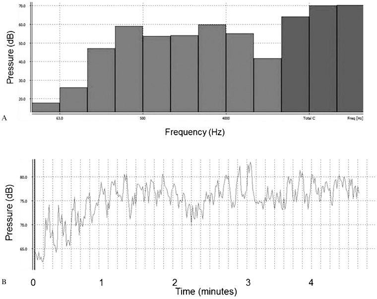 The effects of auditory stimulation with music on heart rate ...