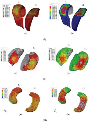 I) Maximum stress on the femoral cartilage and b) the contact pressure on the femoral cartilage; II) a) the maximum stress on the tibial cartilage and b) the contact pressure on the tibial cartilage; III) a) the maximum stress on the meniscus and b) the contact pressure on the meniscus. I) Maximum stress on the femoral cartilage and b) the contact pressure on the femoral cartilage; II) a) the maximum stress on the tibial cartilage and b) the contact pressure on the tibial cartilage; III) a) the maximum stress on the meniscus and b) the contact pressure on the meniscus.