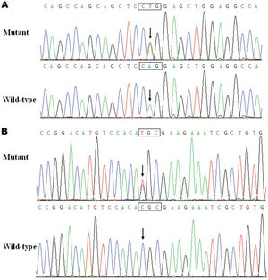 Sequence electropherograms showing the PITX2c mutations in contrast with their corresponding controls. The arrows indicate the heterozygous nucleotides of A/T (Figure1A), mutant) or C/T (Figure1B), mutant) or the homozygous nucleotides of A/A (Figure1A), wild-type) or C/C (Figure1B), wild-type). The rectangle designates the nucleotides comprising a codon of PITX2c.