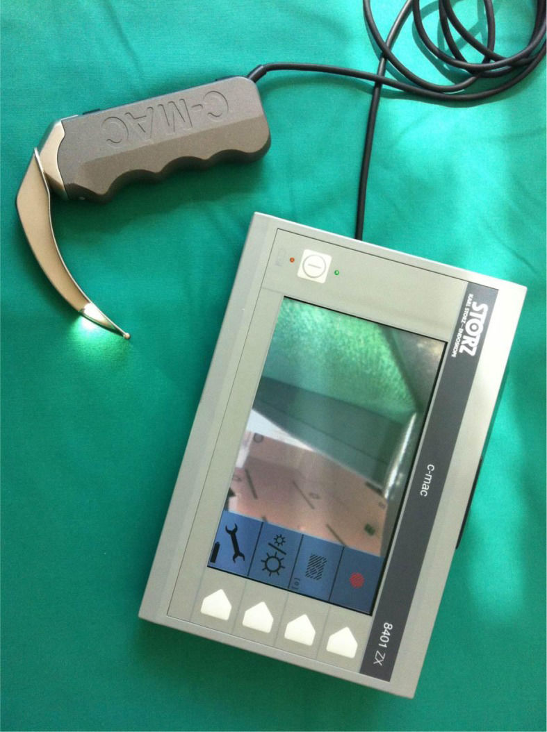 Comparison of the TruView infant EVO2 PCD™ and C-MAC video