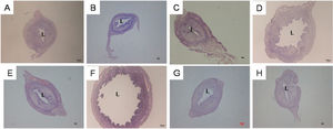 Representative images of uterine sections from ovariectomised SD rats treated with (A) peanut oil (control), (B) 25G (25 mg/kg/day genistein), (C) 25G (25 mg/kg/day genistein) + ICI 182780, (D) 50G (50 mg/kg/day genistein), (E) 50G (50 mg/kg/day genistein + ICI 182780), (F) 100G (100 mg/kg/day genistein), (G) 100G (100 mg/kg/day genistein) + ICI 182780, or (H) ICI 182780 (100 μg/kg/day) only for 3 consecutive days. There was a clear increase in the luminal circumference following treatment with 50 and 100 mg/kg/day genistein, although these changes were antagonised by treatment with ICI 182780. Sections were stained with H&E, and the magnification is X4. L indicates the uterine lumen. (G-genistein), n = 6 per treatment group.
