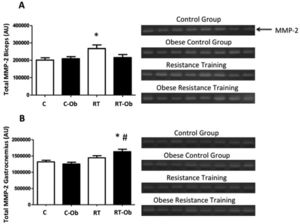 Effects of resistance training and high-fat diet on total MMP-2 activity in biceps (A) and gastrocnemius (B) muscles. Total MMP-2 activity was determined by adding the integrated optical densities obtained (expressed in arbitrary units) for the three bands (pro-, intermediate, and active MMP-2 forms). Data are reported as means±SEM (p<0.05). *Statistically significant difference compared to C; #statistically significant difference compared to C-Ob.