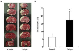 The cerebral infarction area after MCAO in rats from the various groups. Figure1A shows representative photographs of coronal sections of rat brains. From left to right are the MCAOs in the control rats and fatigued rats, respectively. The white areas represent the infarct regions. Figure1B shows the infarct ratios in rats from the various groups. The infarct ratio was calculated as the percentage of infarcted tissue per ipsilateral hemisphere. In the control group, the infarct ratio was 8%. In the fatigued group, the infarct ratio was markedly increased (24%) over that of the control group. *, p<0.05.