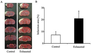 Cerebral infarction area after MCAO in rats of different groups. Supplemental figure 1A shows representative photographs of coronal sections of rat brains. From left to right are the MCAO in the control rats and exhaustive rats respectively. The white areas represent the infarct regions. Supplemental figure 1B shows the infarct ratio in rats of different groups. The infarct ratio was calculated as the % infarcted tissue per ispilateral hemisphere. In the control group, the infarct ratio was 8%. In the fatigue group, the infarct ratio was markedly increased when compared with control group (the ratio was 24%). *, p<0.05.