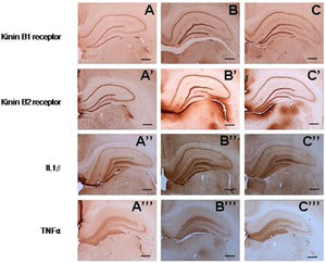 Photomicrographs of hippocampi processed for immunohistochemistry showing expression of the kinin B1 receptor (A, B and C), the kinin B2 receptor (A