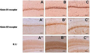 Photomicrographs of the CA1 region of hippocampi processed for immunohistochemistry showing expression of the kinin B1 receptor (A, B and C), the kinin B2 receptor (A