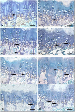 Growth plate photomicrographs of the following: A: non-OVX rats treated for 45 days with vehicle (GC45); B: OVX rats treated for 45 days with vehicle (GV45); C: non-OVX rats treated for 60 days with vehicle (GC60); D: OVX rats treated for 60 days with vehicle (GV60), E: OVX rats treated for 45 days with GS (GE45GS); F: OVX rats treated for 45 days with GS+CS (GE45GS+CS); G: OVX rats treated for 60 days with GS (GE60GS); and H: OVX rats treated for 60 days with GS+CS (GE60GS+CS). Histochemical staining of hyaluronan counterstained with methyl green (arrows). Scale bar = 50 µm.
