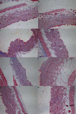 Histological evaluation of Masson