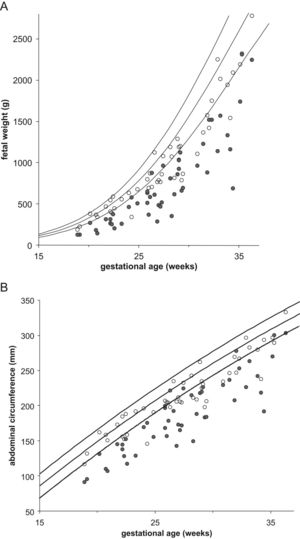 Scatterplots of estimated fetal weight (A) and abdominal circumference measurements (B) of 47 twin pregnancies with placental insufficiency plotted against singleton reference ranges. Closed circles: fetuses with absent or reverse end-diastolic flow in the umbilical artery; open circles: co-twin with normal Doppler.