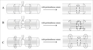 Various suture techniques used for mechanical testing. A. Modified Kessler suture with peritendinous suture (MK); B. Interlock suture with peritendinous suture (IS); C. Modified Kessler-loop lock suture with peritendinous suture (MKL).