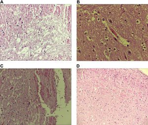 Examples of hematoxylin-eosin-stained histological slides showing the area of the spinal cord lesion. A - intense degeneration of neural tissue (200x magnification); B - intense hyperemia (400x magnification); C - moderate degree of infiltration and cystic degeneration (100x magnification) and D - an area close to the spinal cord lesion with no alterations (100x magnification).