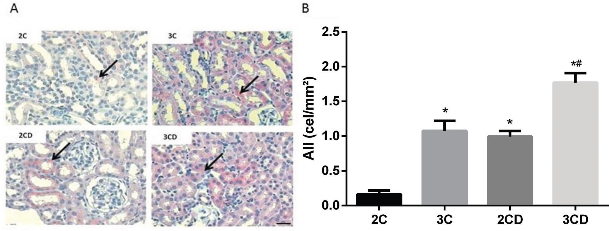 ACE gene dosage determines additional autonomic dysfunction and