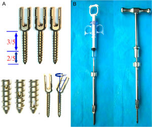 (A) The design of the CICPS; (B) The CICPS connects to the specially designed bone cement syringe and the T-shaped handle through an adapter.