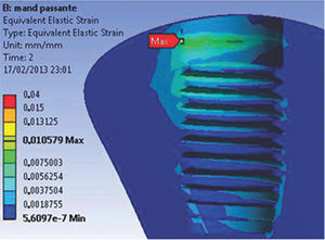 EQV strain for the M2 model. Notably, the strain is higher for this model; however, the average values are similar to those of the M1 model. EQV strain for the M2 model. Notably, the strain is higher for this model; however, the average values are similar to those of the M1 model.