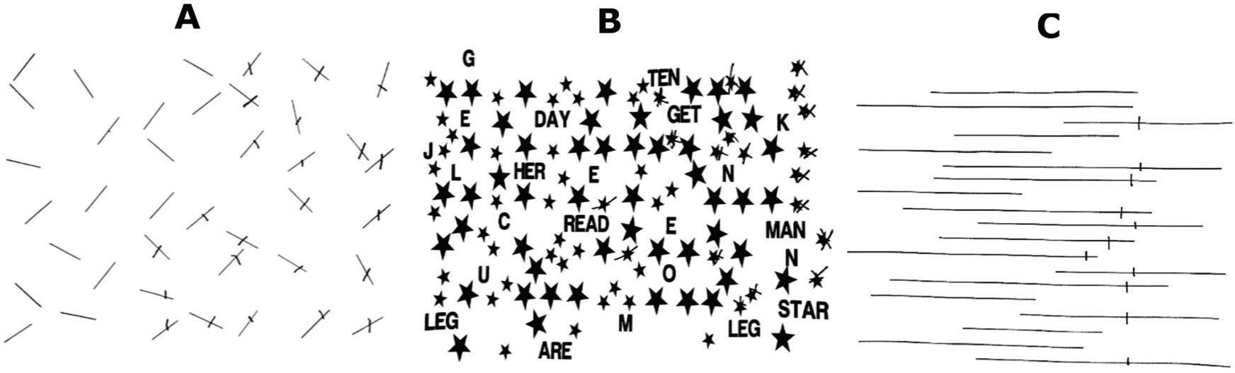 Norm scores of cancelation and bisection tests for unilateral spatial ...