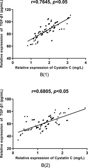 Correlative analysis of serum TGF-β1 and cystatin C in group B. According to the Pearson correlation coefficient analysis, there is a positive correlation between the serum levels of TGF-β1 and cystatin C before and after treatment in group B (r=0.7645 versus r=0.6805, p<0.05).