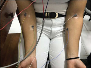 Positioning of electrodes on the forearm.