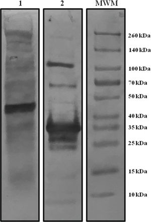 Digital images of protein patterns after western blotting using hyperimmune serum (from a patient with moderate symptoms) for the two ELISA antigens. Lane 1: Whole viral antigen pattern (WVA). Lane 2: Recombinant nucleoprotein (rNP) pattern. MWM: markers with known molecular weights.