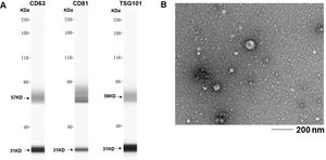 Western blotting analysis of the exosomal preparations showing the expression of the exosomal markers CD63, CD81, and TSG101.