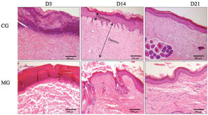 Histological photographs showing the thickness of the dermis and epidermis over time (H & E, 10×).