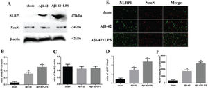 (A) Western blotting assay for detecting the expression of NLRP1 and NeuN. (B, C) Quantification of the expression of NLRP1 and NeuN. (D) NLRP1/NeuN ratio. (E) Immunofluorescence assay for detecting the expression of NLRP1 and NeuN (×400) and (F) NLRP1/NeuN (+) cells in samples from the sham, Aβ1-42, and Aβ1-42+LPS groups. Protein levels were normalized to those of β-actin (Aβ1-42 vs. sham group, **p<0.05; Aβ1-42+LPS vs. Aβ1-4 group, ##p<0.05, n=6 per group. All data were represented as the mean±standard error).
