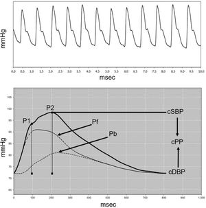 Pulse waves from the brachial (A) and aortic (B) arteries in a female teenager. P1=First systolic peak; P2=Second systolic peak; Pf=Forward or ejection wave; Pb=Backward or reflection wave; cSBP and cDBP=central systolic and diastolic blood pressure; cPP=central pulse pressure. AIx@75=(P2-P1)/cPP*100 corrected for a heart rate of 75 bpm.