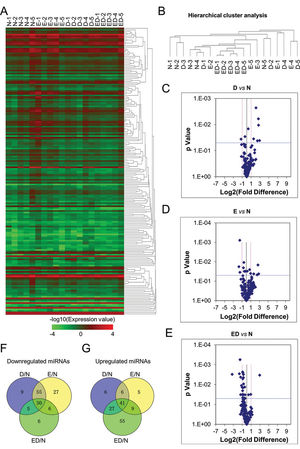 Comparation of plasma miRNA expression profile among patients and healthy donors. A Heatmap assay of the differentially expressed miRNAs in plasma samples of healthy donors (N-1, N-2, N-3, N-4, N-5), patients with essential hypertension (E-1, E-2, E-3, E-4, E-5), type 2 diabetes (D-1, D-2, D-3, D-4, D-5), patients with essential hypertension and type 2 diabetes mellitus (ED-1, ED-2, ED-3, ED-4, ED-5). B Hierarchical cluster analysis of plasma miRNA expression profile among patients (E, D, ED) and healthy donors (N). C-E The scatter plots illustration of differentially expressed miRNAs between the D and N groups (C), E and N groups (D), and ED and N groups (E). F-G Venn Map analysis of the distributions of the differentially downregulated (F) or upregulated (G) miRNAs in plasma samples among the indicated groups (N, E, D, and ED).