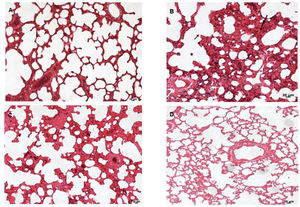 Lung photomicrograph of rats where melatonin and NAC were administered to attenuate lung injury induced by intestinal ischemia-reperfusion (iLR). A (sham): Normal appearance; B (SS+iIR): alveolar edema (*), destruction of the alveolar septum (small arrow), inflammation (long arrow); C (NAC+iIR): moderate edema/inflammation, destruction of the alveolar septum, and congestion; D (MEL+iIR): mild to moderate congestion, reduced inflammation, and destruction of the alveolar septum. Hemoatoxylin eosin 200X.