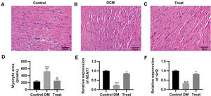 Treatment with the combination of dendrobium mixture and metformin improved the morphology of heart tissues in rats with streptozotocin-induced diabetes mellitus. A-C, Hematoxylin and eosin staining of the heart tissue of the rats in each group; D, Treatment with dendrobium mixture and metformin improved myocardial cell size in streptozotocin-induced diabetic rats; and E-F, upregulated the expression of NEAT1 and Nrf2. *p<0.05, ***p<0.001, Kruskal-Wallis test followed by Dunn's multiple comparisons test. DCM, diabetic cardiomyopathy.