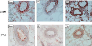 Immunohistochemistry analysis of the expression of endothelial nitric oxide synthase (eNOS) and endothelin (ET-1) in mesenteric vessels. Original magnification, ×40 for all images. In rats with I/R injury, the superior mesenteric artery was clamped (45 min), followed by intestinal reperfusion (2h). Estradiol (180 µg/kg, i.v.) was administered 30 min after the induction of intestinal ischemia (E30). Sham-operated rats were used as controls. I/R, ischemia and reperfusion.