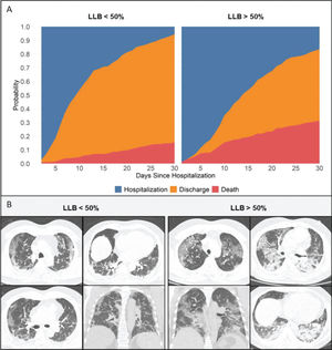 A) Cumulative incidence plots for the three possible outcomes (mortality, discharged, and continued hospitalization) according to the LLB. B) Chest CT illustrating an LLB of <50% (left images) and LLB of >50% (right images).