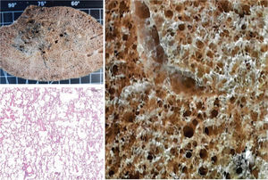 Example of a non-COVID-19, preserved lung, fixed with gaseous formaldehyde at 30 cm H2O for 48h. Lung parenchyma shows preserved architecture and normal histology, except for areas of anthracosis (black dots in upper left panel).