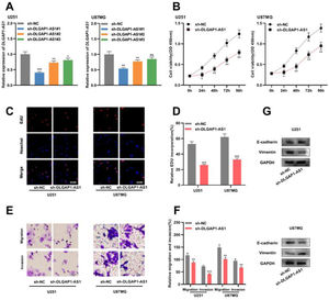 DLGAP1-AS1 knockdown suppresses the proliferation, migration, invasion, and EMT of glioma cells. A, sh-NC, sh-DLGAP1-AS1#1, sh-DLGAP1-AS1#2, and sh-DLGAP1-AS1#3 were transfected into U251 and U87MG cells to construct low expression models of DLGAP1-AS1, and the transfection efficiency was determined using qRT-PCR. (B–D) The proliferation of U251 and U87MG cells transfected with sh-NC or sh-DLGAP1-AS1#1 was detected using CCK-8 (B) and EdU assays (C–D). (E–F) Transwell assay was used to detect the migration and invasion of U251 cells (E) and U87MG cells (F) transfected with sh-NC or sh-DLGAP1-AS1#1. G, The expression levels of EMT-related proteins E-cadherin and vimentin in U251 and U87MG cells transfected with sh-NC or sh-DLGAP1-AS1#1 were detected using western blotting. The experiments were repeated three times, and the average was recorded. *p < 0.05, **p < 0.01, and ***p < 0.001, ns was not statistically significant.